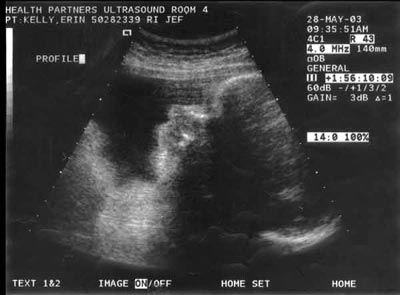 UltraSound_28May.jpg